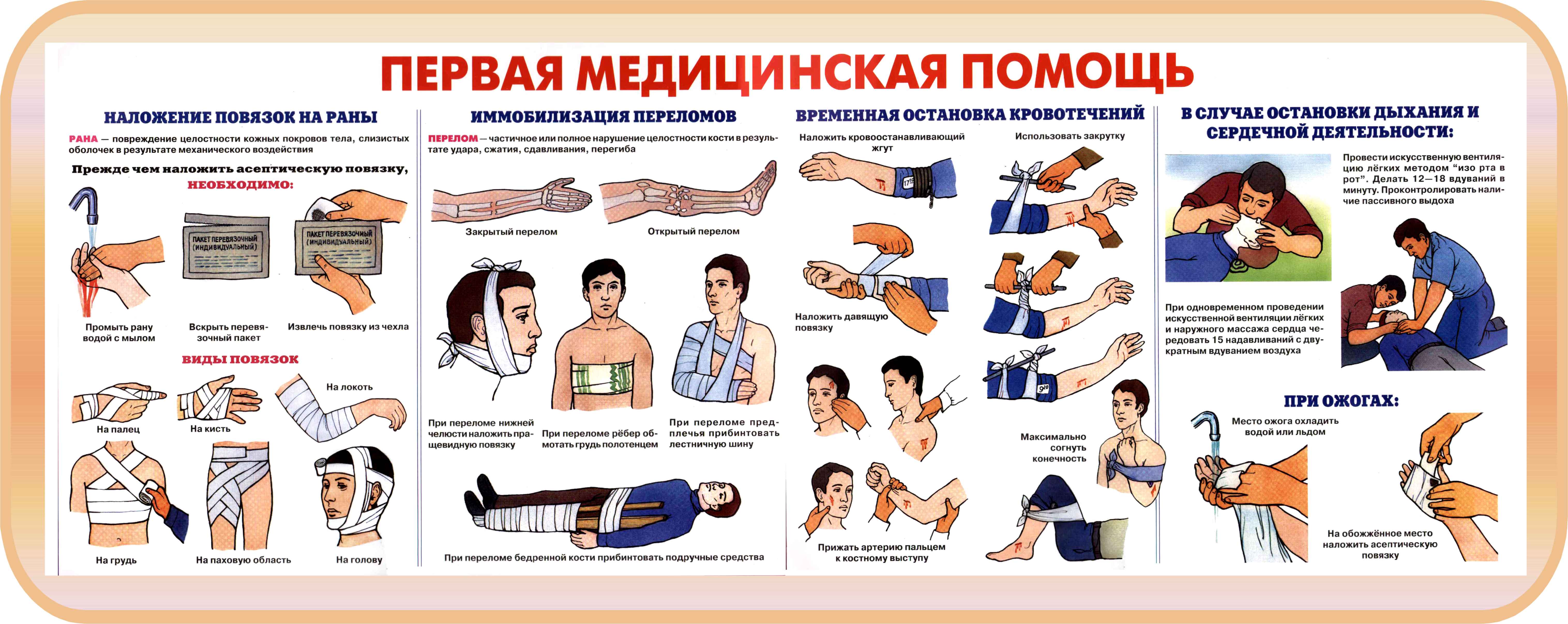 Лекция № 15 Оказание само- и взаимопомощи при ранениях, кровотечениях, переломах, ожогах. Основы ухода за больными».